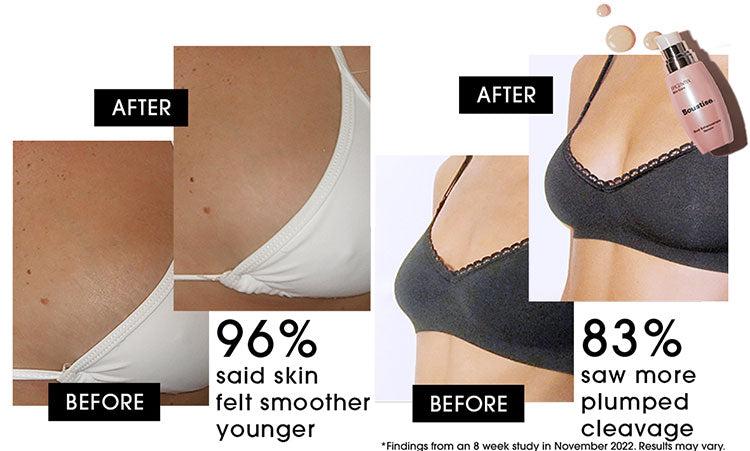 Boustise-breast-enhancement-cream-serum-lifting-firming-tightening-results.jpg